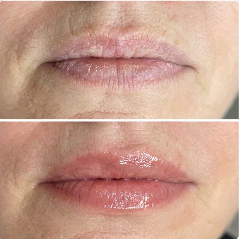 Before and after